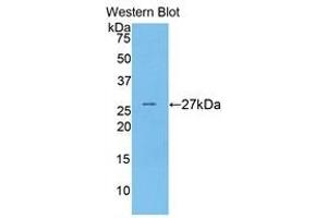 Western Blotting (WB) image for anti-Coagulation Factor IX (F9) (AA 241-463) antibody (ABIN1858772) (Coagulation Factor IX Antikörper  (AA 241-463))
