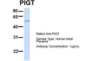 Host:  Rabbit  Target Name:  PIGT  Sample Type:  Human Adult Placenta  Antibody Dilution:  1. (PIGT Antikörper  (C-Term))