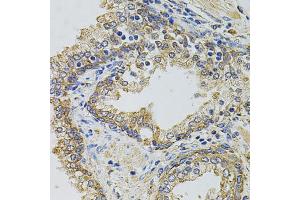 Immunohistochemistry of paraffin-embedded human prostate using GM13125 antibody. (Pramel15 Antikörper)