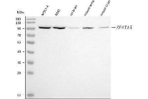 Western blot analysis of SPATA5 using anti-SPATA5 antibody (ABIN7599767).