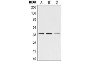 Western blot analysis of ZADH2 expression in Jurkat (A), Raw264. (ZADH2 Antikörper  (Center))