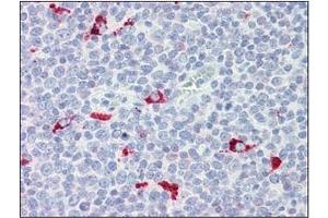 Immunohistochemistry (IHC) image for anti-Interferon Regulatory Factor 7 (IRF7) (AA 1-150), (N-Term) antibody (ABIN263914) (IRF7 Antikörper  (N-Term))