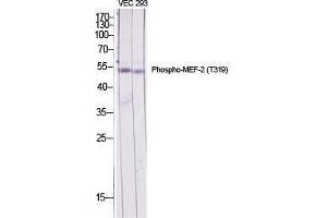Western Blot (WB) analysis of specific cells using Phospho-MEF-2 (T319) Polyclonal Antibody. (MYEF2 Antikörper  (pThr319))