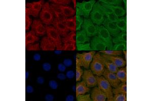 ABIN6257505 and ABIN6276213 staining Hela cells by IF/ICC.