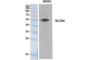 Western Blotting (WB) image for anti-Solute Carrier Family 2 (Facilitated Glucose Transporter), Member 4 (SLC2A4) (Internal Region) antibody (ABIN6287607)