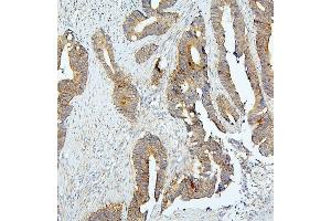 IHC analysis of BUB1B using anti-BUB1B antibody (ABIN7600962). (BUB1B Antikörper  (AA 26-448))