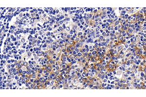 Detection of CD23 in Human Amygdalitis Tissue using Polyclonal Antibody to Cluster Of Differentiation 23 (CD23) (FCER2 Antikörper  (AA 151-321))