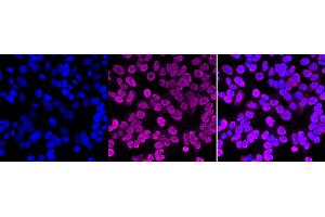 Immunocytochemical staining of HAP-1 cells with PTBP1 antibody (ABIN7799882), 1:1,000). (Rekombinanter PTBP1 Antikörper)