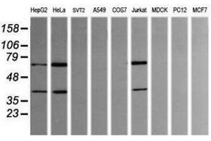 Image no. 1 for anti-tRNA Methyltransferase 2 Homolog A (TRMT2A) antibody (ABIN1501515) (TRMT2A Antikörper)