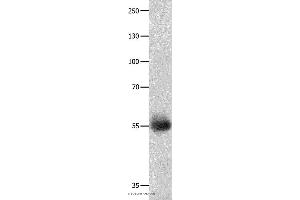 Western blot analysis of Human ovarian cancer tissue, using DRD5 Polyclonal Antibody at dilution of 1:800 (DRD5 Antikörper)