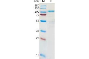 Human LRRC32 Protein, hFc Tag on SDS-PAGE under reducing condition. (LRRC32 Protein (Fc Tag))