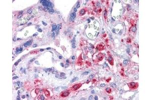 IHC testing of FFPE human placental tissue with XCT antibody at 3. (SLC7A11 Antikörper)