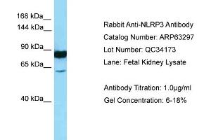Western Blotting (WB) image for anti-NLR Family, Pyrin Domain Containing 3 (NLRP3) (N-Term) antibody (ABIN2789437) (NLRP3 Antikörper  (N-Term))