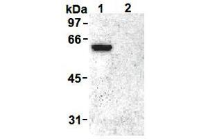 Western Blotting (WB) image for anti-Vimentin (VIM) (pSer55) antibody (ABIN1109485) (Vimentin Antikörper  (pSer55))