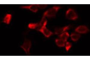 ABIN6274547 staining HeLa by IF/ICC. (JIP3 Antikörper  (Internal Region))