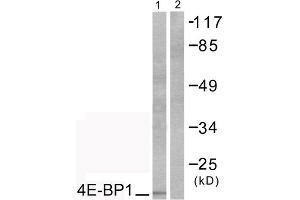 Western blot analysis of extracts from COS7 cells, treated with EGF (200ng/ml, 30mins), using 4E-BP1 (epitope around residue 69) antibody (ABIN5976164). (eIF4EBP1 Antikörper  (Thr70))