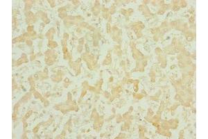 Immunohistochemistry of paraffin-embedded human liver tissue using ABIN7159686 at dilution of 1:100 (CHCHD3 Antikörper  (AA 1-227))