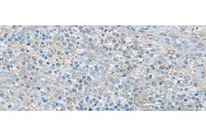 Immunohistochemistry of paraffin-embedded Human tonsil tissue using PYCR2 Polyclonal Antibody at dilution of 1:40(x200) (PYCR2 Antikörper)