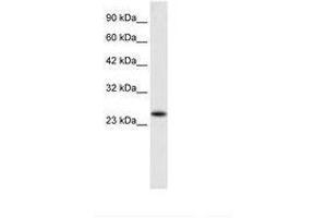Image no. 1 for anti-Charged Multivesicular Body Protein 3 (CHMP3) (AA 28-77) antibody (ABIN6735908) (CHMP3 Antikörper  (AA 28-77))