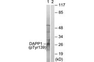Western Blotting (WB) image for anti-Dual Adaptor of Phosphotyrosine and 3-phosphoinositides (DAPP1) (AA 105-154), (pTyr139) antibody (ABIN1531577)