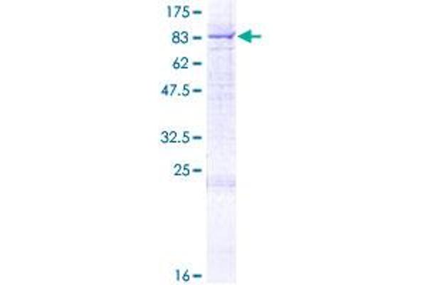 Seladin 1 Protein (AA 1-516) (GST tag)