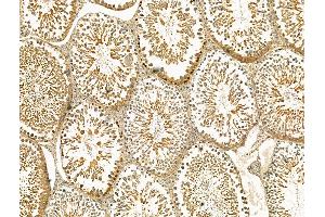 ABIN7094437 and ABIN7098485 at 1/100 staining Rat testis tissue by IHC-P. (STRA8 Antikörper  (Internal Region))