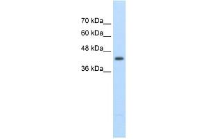 WB Suggested Anti-UPB1 Antibody Titration:  2. (UPB1 Antikörper  (Middle Region))