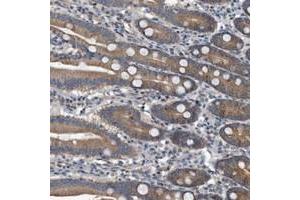 Immunohistochemical staining of human duodenum with FAM136A polyclonal antibody  shows moderate cytoplasmic positivity in glandular cells at 1:200-1:500 dilution. (FAM136A Antikörper)