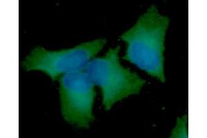 ICC/IF analysis of BECN1 in HeLa cells line, stained with DAPI (Blue) for nucleus staining and monoclonal anti-human BECN1 antibody (1:100) with goat anti-mouse IgG-Alexa fluor 488 conjugate (Green). (Beclin 1 Antikörper  (AA 1-450))