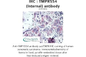 Image no. 2 for anti-Transmembrane Protease, serine 4 (TMPRSS4) (Internal Region) antibody (ABIN1740175)
