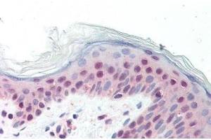 Human Skin: Formalin-Fixed, Paraffin-Embedded (FFPE)