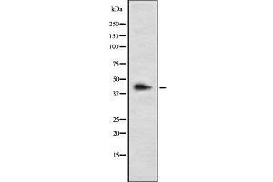 Western blot analysis of LHX3 using HepG2 whole cell lysates (LHX3 Antikörper  (C-Term))