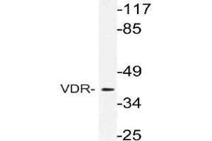 Western blot (WB) analysis of VDR antibody in extracts from Jurkat cells.