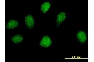 Immunofluorescence of purified MaxPab antibody to MGC16943 on HeLa cell. (ERI2 Antikörper  (AA 1-328))