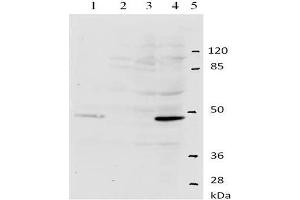 Western-Blot analysis of HPV-11 E2 protein. (Human Papilloma Virus 11 E2 (HPV-11 E2) (AA 202-284) Antikörper)