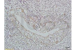 Formalin-fixed and paraffin-embedded: rat liver tissue labeled with Rabbit Anti-BAFF/CD257 Polyclonal Antibody, Unconjugated (ABIN740175) 1:200 followed by conjugation to the secondary Cy3 antibody (BAFF Antikörper  (AA 221-309))
