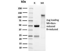 SDS-PAGE Analysis Purified SOX9 Recombinant Rabbit Monoclonal Antibody (SOX9/3141R). (Rekombinanter SOX9 Antikörper  (AA 393-508))