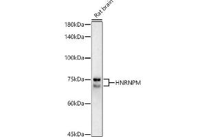 Western blot analysis of extracts of Rat brain, using HNRNPM antibody (ABIN7267635) at 1:1000 dilution. (HNRNPM Antikörper)