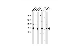 Western blot analysis of lysates from A431, CEM, Jurkat, K562 cell line (from left to right), using ITK Antibody (Center) (ABIN6243870 and ABIN6577737). (ITK Antikörper  (AA 228-262))