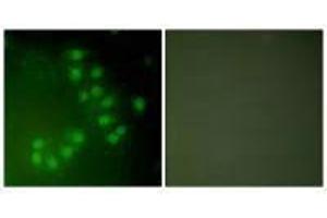 Immunofluorescence analysis of A549 cells, using p63 antibody. (p63 Antikörper)