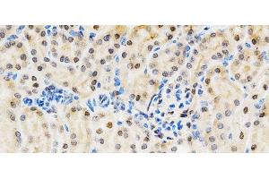 Immunohistochemistry of paraffin-embedded Mouse kidney using LGALS3 Polyclonal Antibody at dilution of 1:200 (40x lens). (Galectin 3 Antikörper)