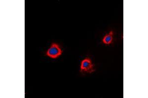 Immunofluorescent analysis of PTTG1IP staining in A549 cells. (PTTG1IP Antikörper  (Center))