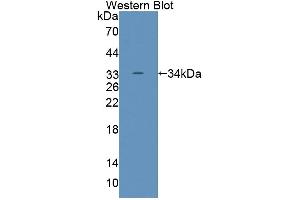 Western Blotting (WB) image for anti-ATP-Binding Cassette, Sub-Family G (WHITE), Member 8 (ABCG8) (AA 1-271) antibody (ABIN5013204)