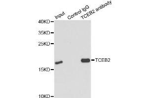 Immunoprecipitation analysis of 150ug extracts of MCF7 cells using 3ug TCEB2 antibody (ABIN6292903). (TCEB2 Antikörper)