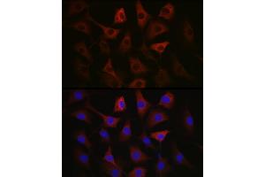 Immunofluorescence analysis of NIH/3T3 cells using GAPDH Mouse mAb (ABIN3020540, ABIN3020541, ABIN3020542 and ABIN1512934) at dilution of 1:100 (40x lens). (GAPDH Antikörper)