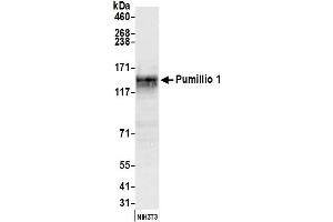 Western Blotting (WB) image for anti-Pumilio Homolog 1 (PUM1) (AA 225-275) antibody (ABIN7450619)
