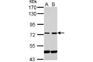 WB Image Sample (30 ug of whole cell lysate) A: Jurkat B: Raji 7. (GLMN Antikörper)