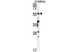 Western blot analysis of FKBP9 antibody (N-term) in mouse kidney tissue lysates (35 µg/lane). (FKBP9 Antikörper  (N-Term))