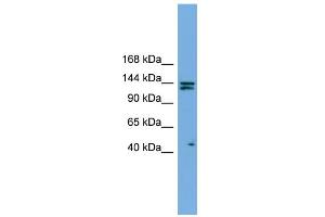 WB Suggested Anti-IARS Antibody Titration: 0. (IARS Antikörper  (Middle Region))