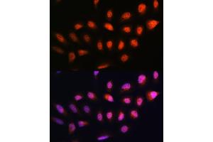 Immunofluorescence analysis of U2OS cells using NPLOC4 Rabbit pAb (ABIN1681086, ABIN5664262, ABIN5664264 and ABIN6220175) at dilution of 1:100.